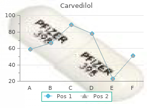 order generic carvedilol