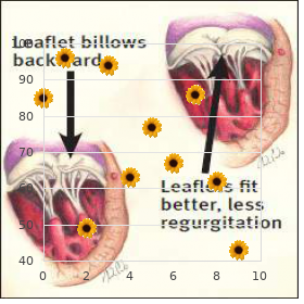 Cutis laxa corneal clouding mental retardation