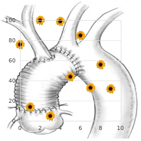 Progressive systemic sclerosis