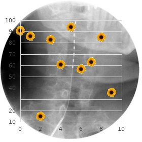 Bone fragility craniosynostosis proptosis hydrocephalus