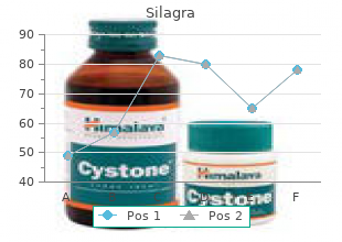 buy silagra 50mg line