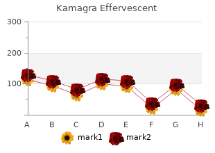 cheap kamagra effervescent online mastercard