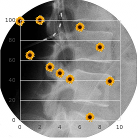 Mandibulofacial dysostosis deafness postaxial polydactyly