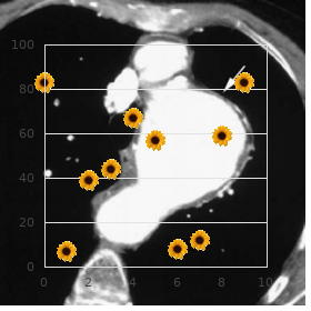 Biemond syndrome