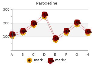 buy paroxetine 10mg otc