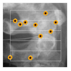 Adolescent benign focal crisis