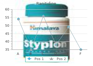 buy ranitidine 150mg lowest price