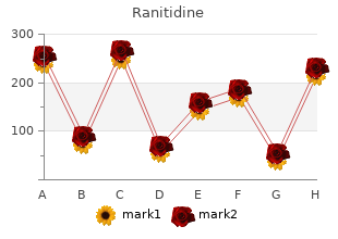 purchase ranitidine amex