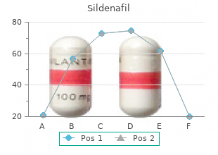 discount sildenafil express