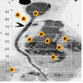 Adrenal gland hypofunction