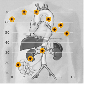 Carpo tarsal osteolysis recessive