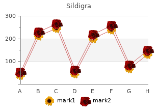 cheap sildigra express