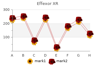 order effexor xr master card