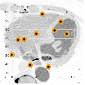 Midline developmental field defects