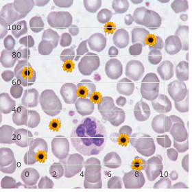17-beta-hydroxysteroid dehydrogenase deficiency, rare (NIH)