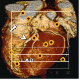 Faciocardiorenal syndrome