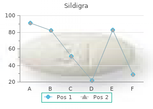 order cheap sildigra online