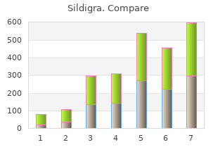 order sildigra 120 mg without prescription