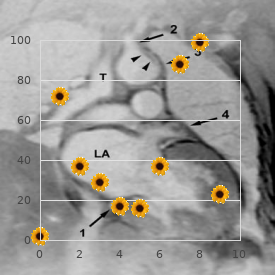 Bicuspid aortic valve