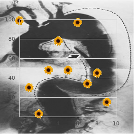 Mandibuloacral dysplasia