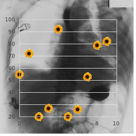 Hereditary sensory and autonomic neuropathy 3