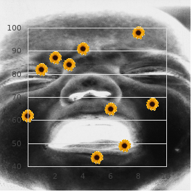 Acrofacial dysostosis ambiguous genitalia