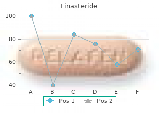 order cheap finasteride line