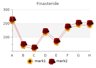 1mg finasteride with amex