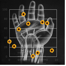 Hypoplasia of the tibia with polydactyly