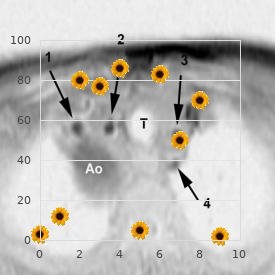 Benign autosomal dominant myopathy