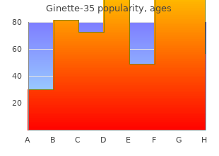 purchase ginette-35 visa