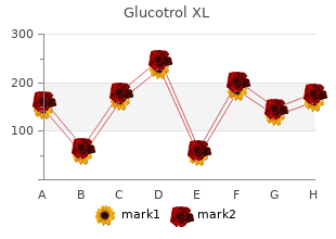 generic glucotrol xl 10mg without a prescription