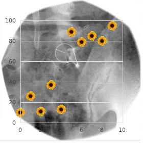 Cataract dental syndrome