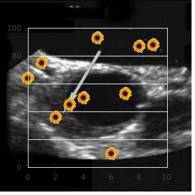 Microphthalmia diaphragmatic hernia Fallot