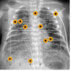 Achromatopsia incomplete, X-linked