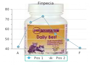purchase cheap finpecia on line