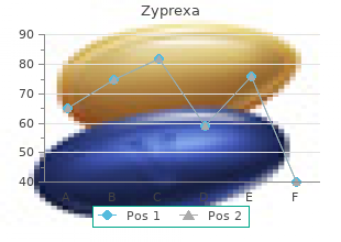 7.5 mg zyprexa amex