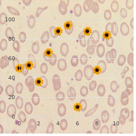 Mycosis fungoides lymphoma