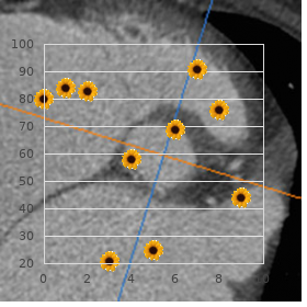 Lymphocytic infiltrate of Jessner