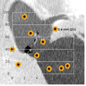 Craniofacial dysynostosis