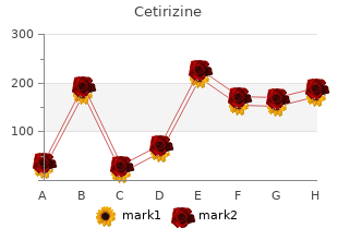 purchase cetirizine 5 mg without a prescription