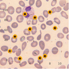 Short rib syndrome Beemer type