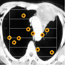 Heart hypertrophy, hereditary