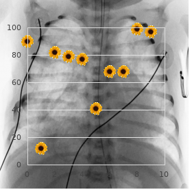 Ectopic coarctation