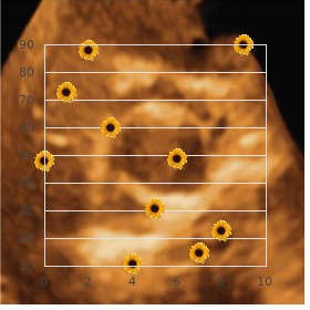 Angiosarcoma of the scalp