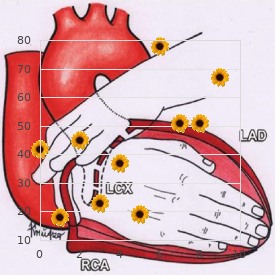 Dermatocardioskeletal syndrome Boronne type