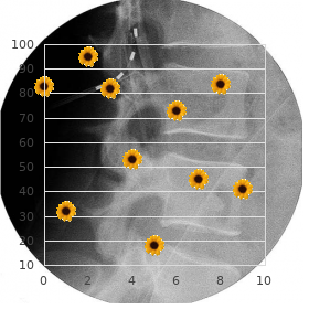 Acropectorovertebral dysplasia