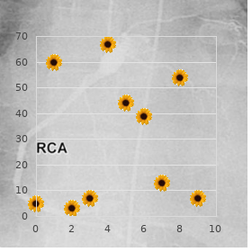 Multiple hereditary exostoses