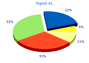 purchase toprol xl 25 mg with visa