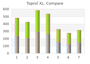 cheap toprol xl 100mg mastercard